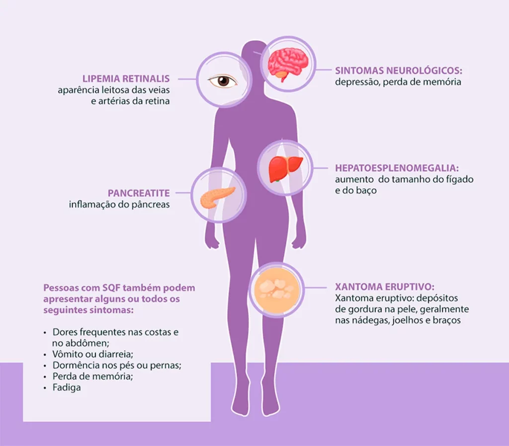 sqf mulher infografico
